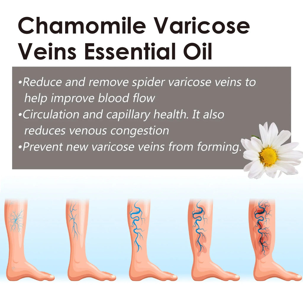 10ml bottle of chamomile essential oil for leg skin care and massage discomfort relief