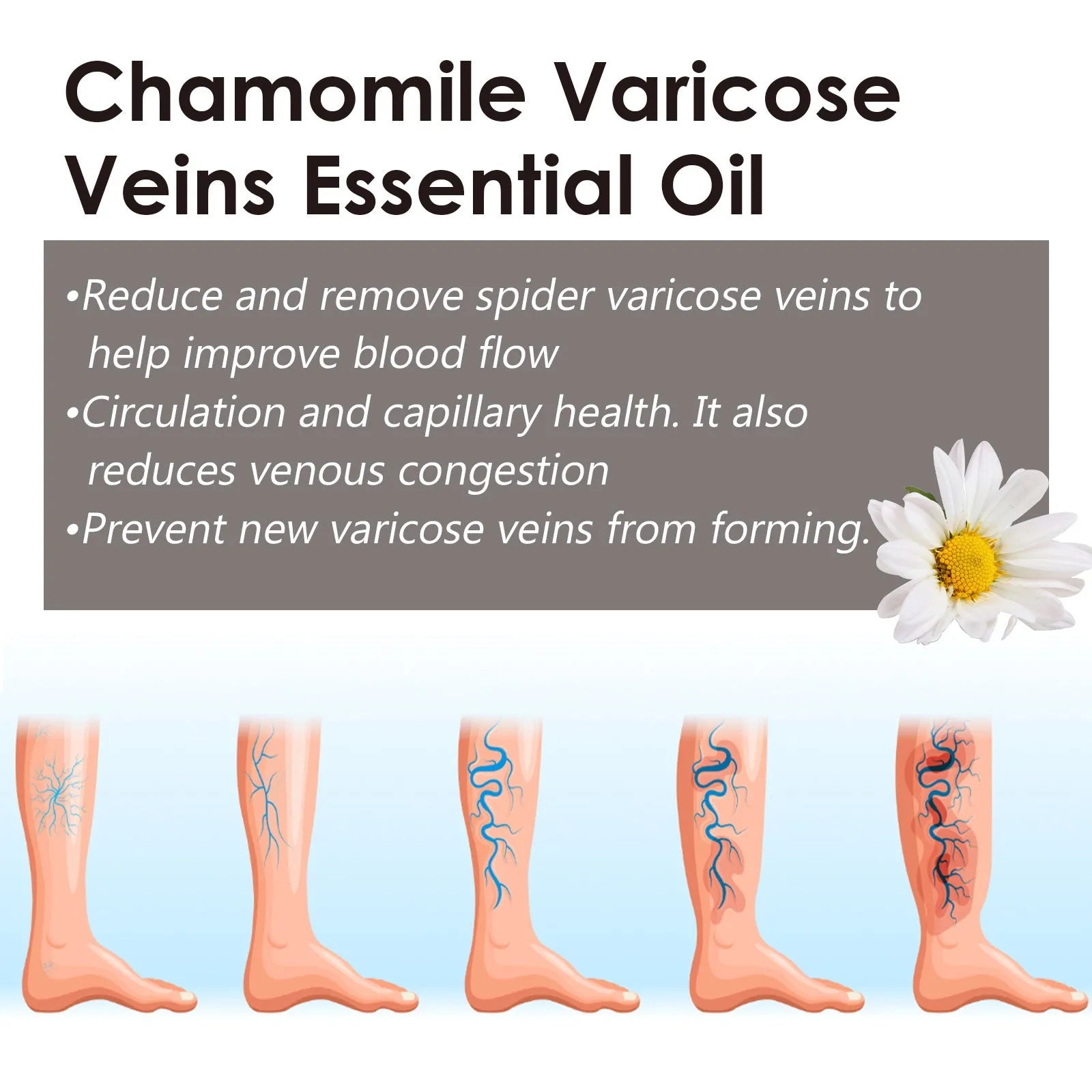 10ml bottle of chamomile essential oil for leg skin care and massage discomfort relief