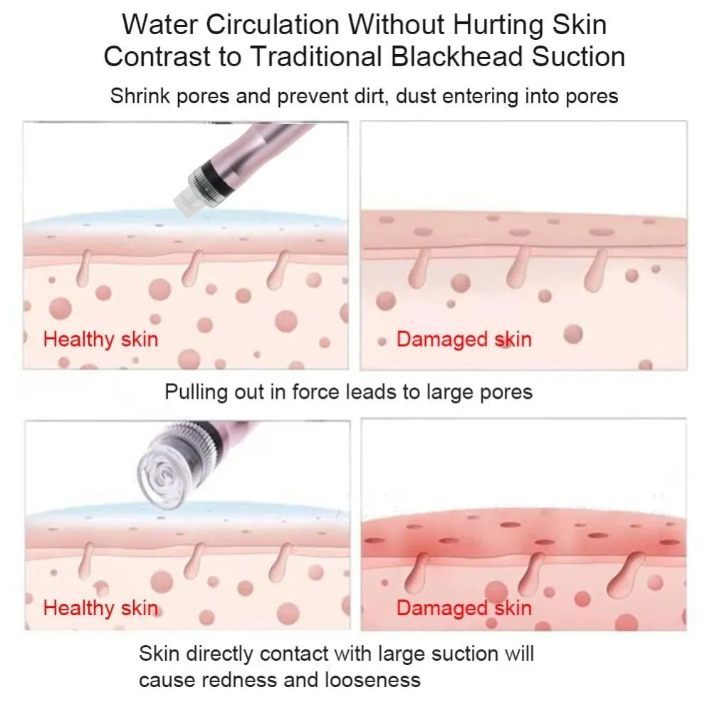 Portable oxygen spray hydro jet machine for blackhead removal and skin rejuvenation, 26cm size, with bottles and crystal heads.