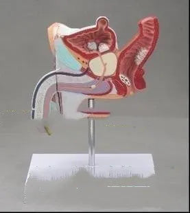 Anatomical plastic model of male internal reproductive disease pathology 25.5x18x15cm on white background