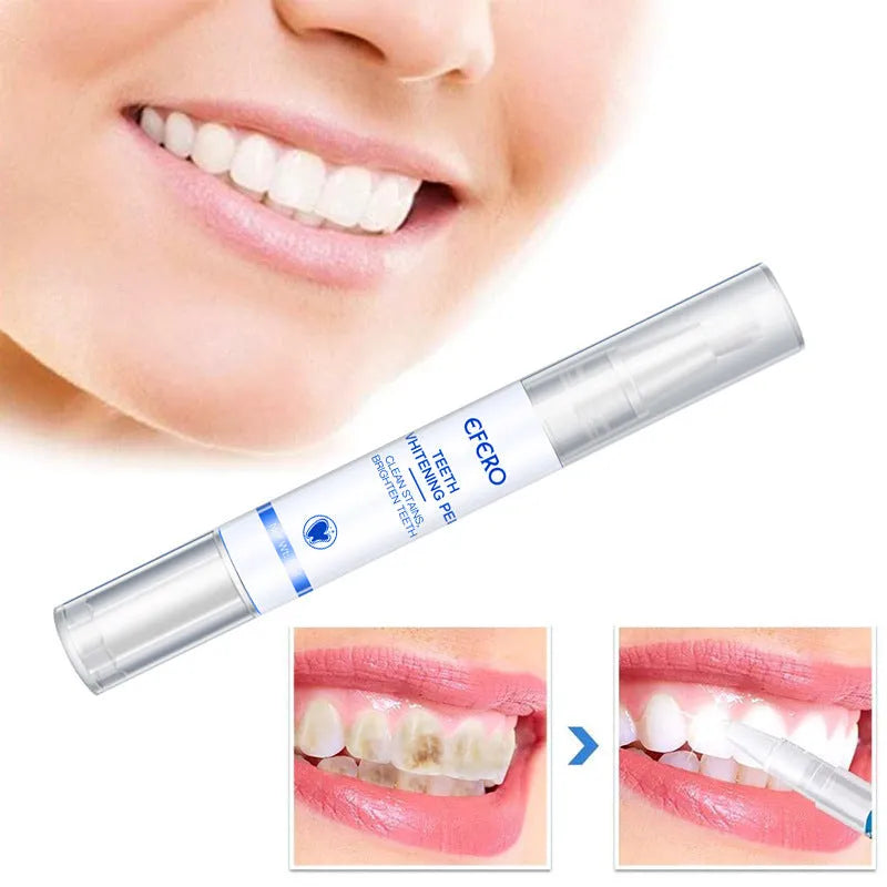 Teeth whitening pen with brush head and 5ml essence, 12.3cm length, for removing plaque and stains