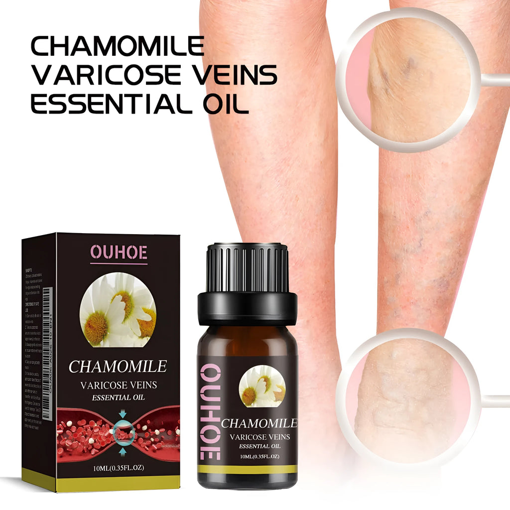 10ml bottle of chamomile essential oil for leg skin care and massage discomfort relief