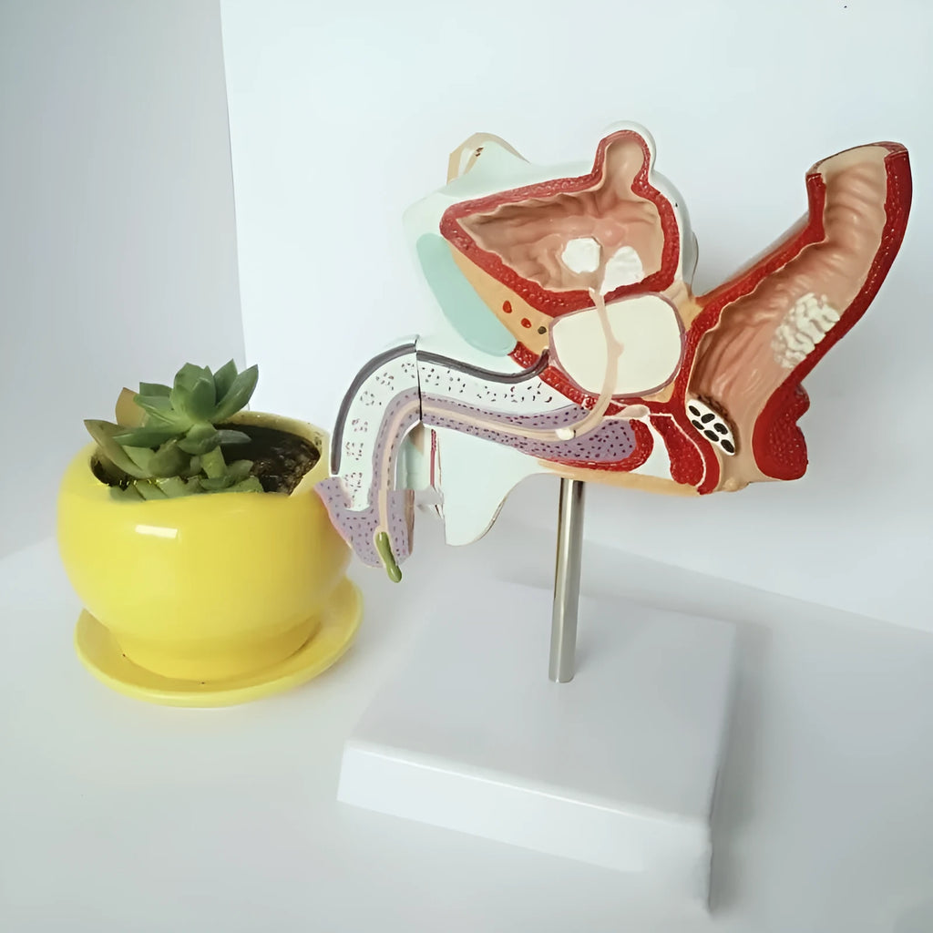 Anatomical plastic model of male internal reproductive disease pathology 25.5x18x15cm on white background