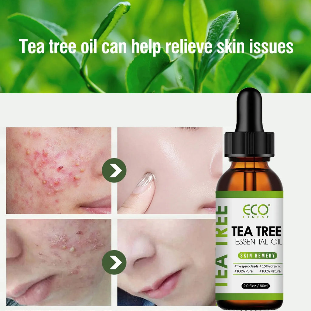 60ml tea tree essential oil bottle for acne treatment massage