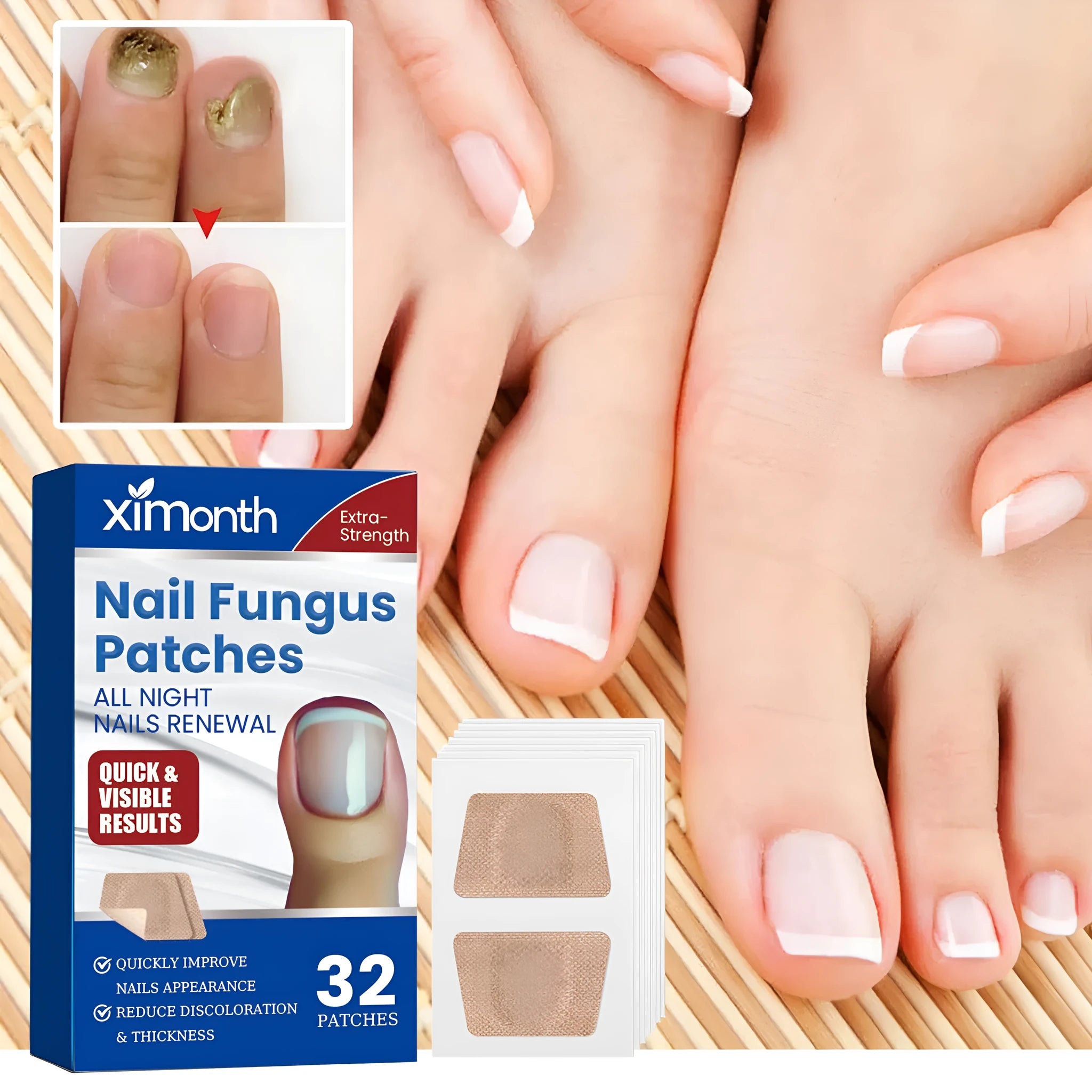 Box of 32 nail nursing adhesive repair bandage patches on a white background.