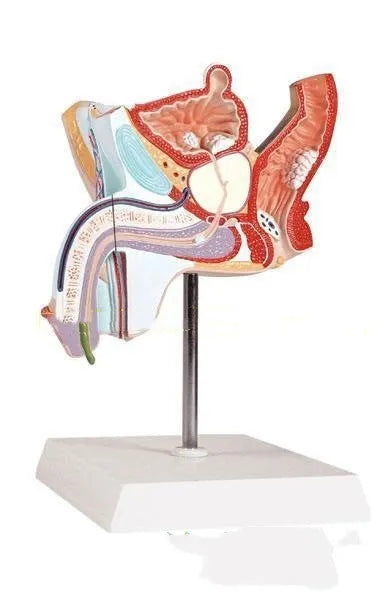 Anatomical plastic model of male internal reproductive disease pathology 25.5x18x15cm on white background