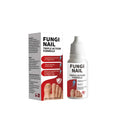 15ml bottle of FP-A072 anti-fungal nail repair solution for fungal nail infections