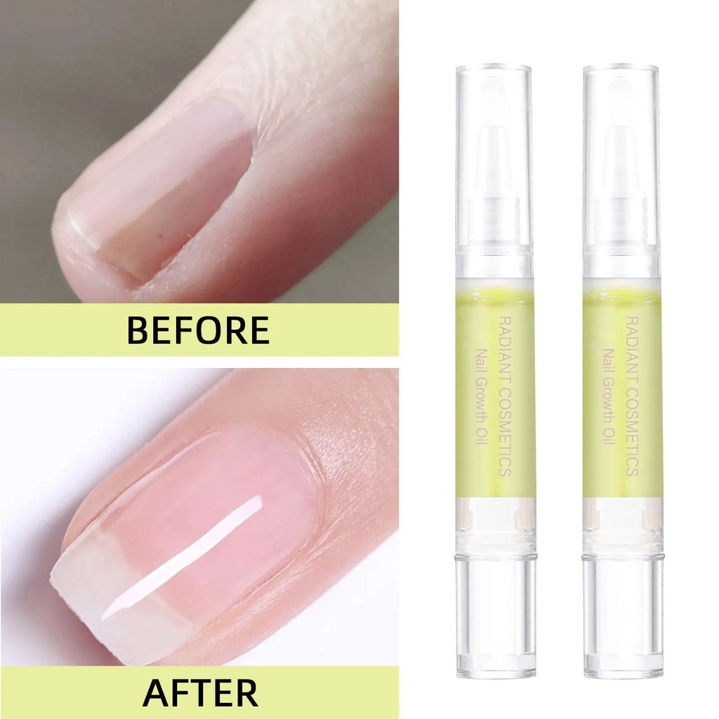3ml bottle of wash-free nail growth oil for strengthening and moisturising treatment