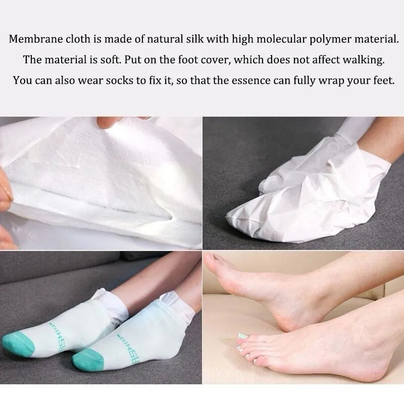Qinduo foot care exfoliating sheet mask 40g nicotinamide treatment membrane of foot colour