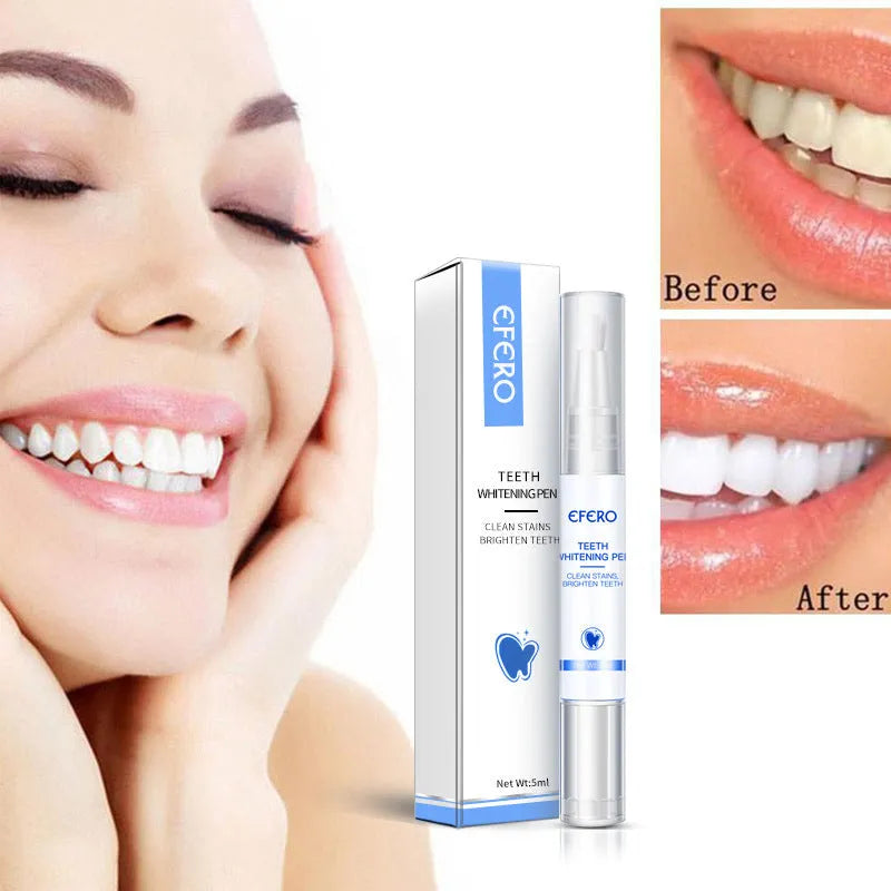 Teeth whitening pen with brush head and 5ml essence, 12.3cm length, for removing plaque and stains