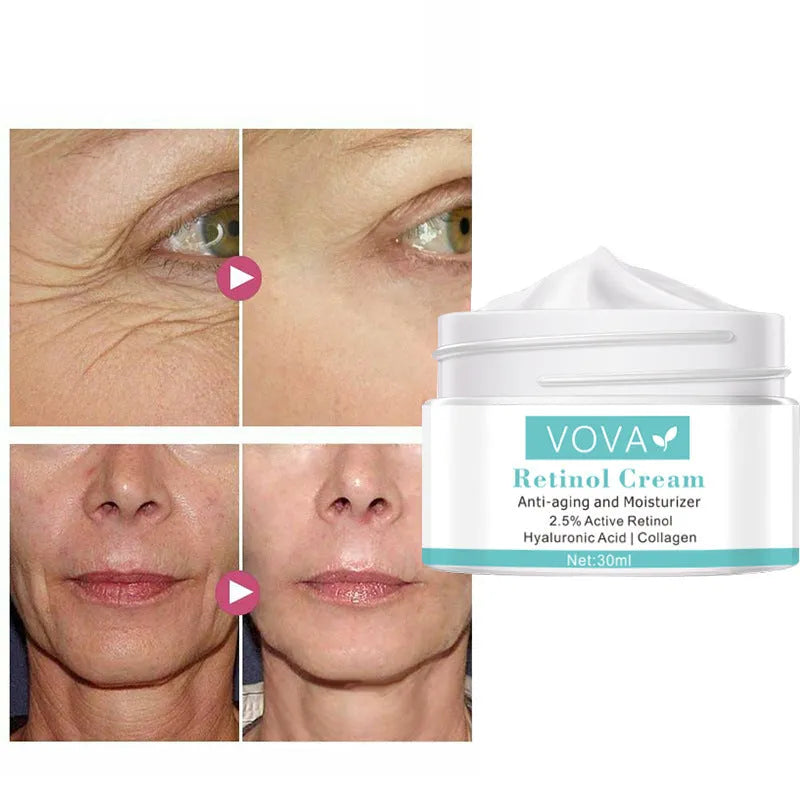 30ml anti-wrinkle cream jar with collagen and hyaluronic acid for tightening and moisturising