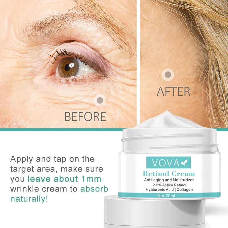 30ml anti-wrinkle cream jar with collagen and hyaluronic acid for tightening and moisturising
