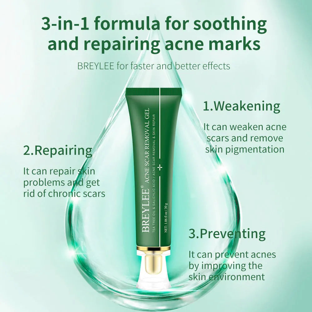 Green acne scar removal gel in a compact tube with tea tree extract for blemish treatment