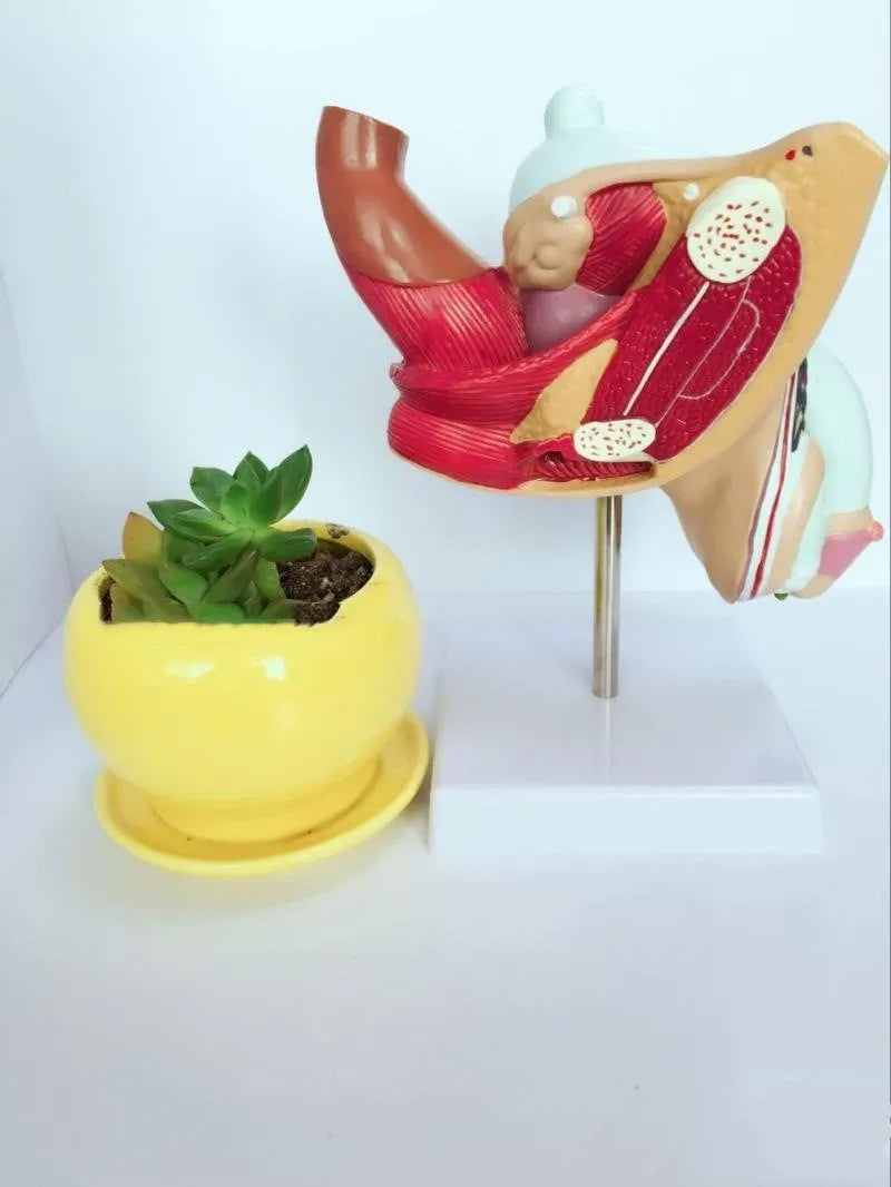Anatomical plastic model of male internal reproductive disease pathology 25.5x18x15cm on white background