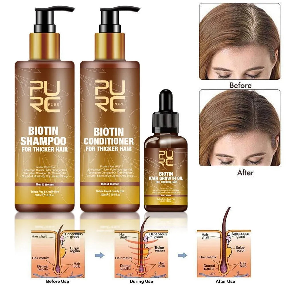 PURC Ginger Biotin Hair Care Set with 300ml shampoo, 300ml conditioner, and 30ml essential oil in white bottles