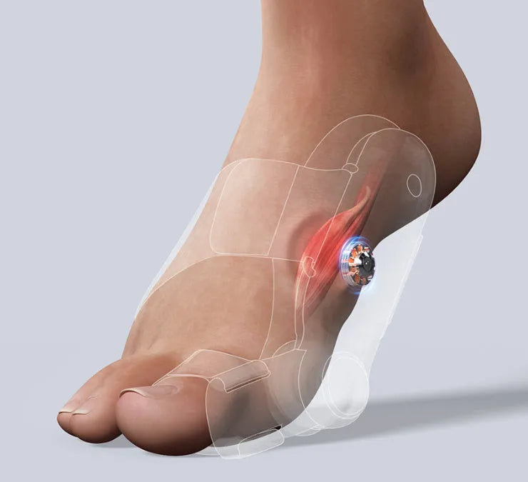 White plastic electric adjustable hallux valgus toe separator with Type-C charging port