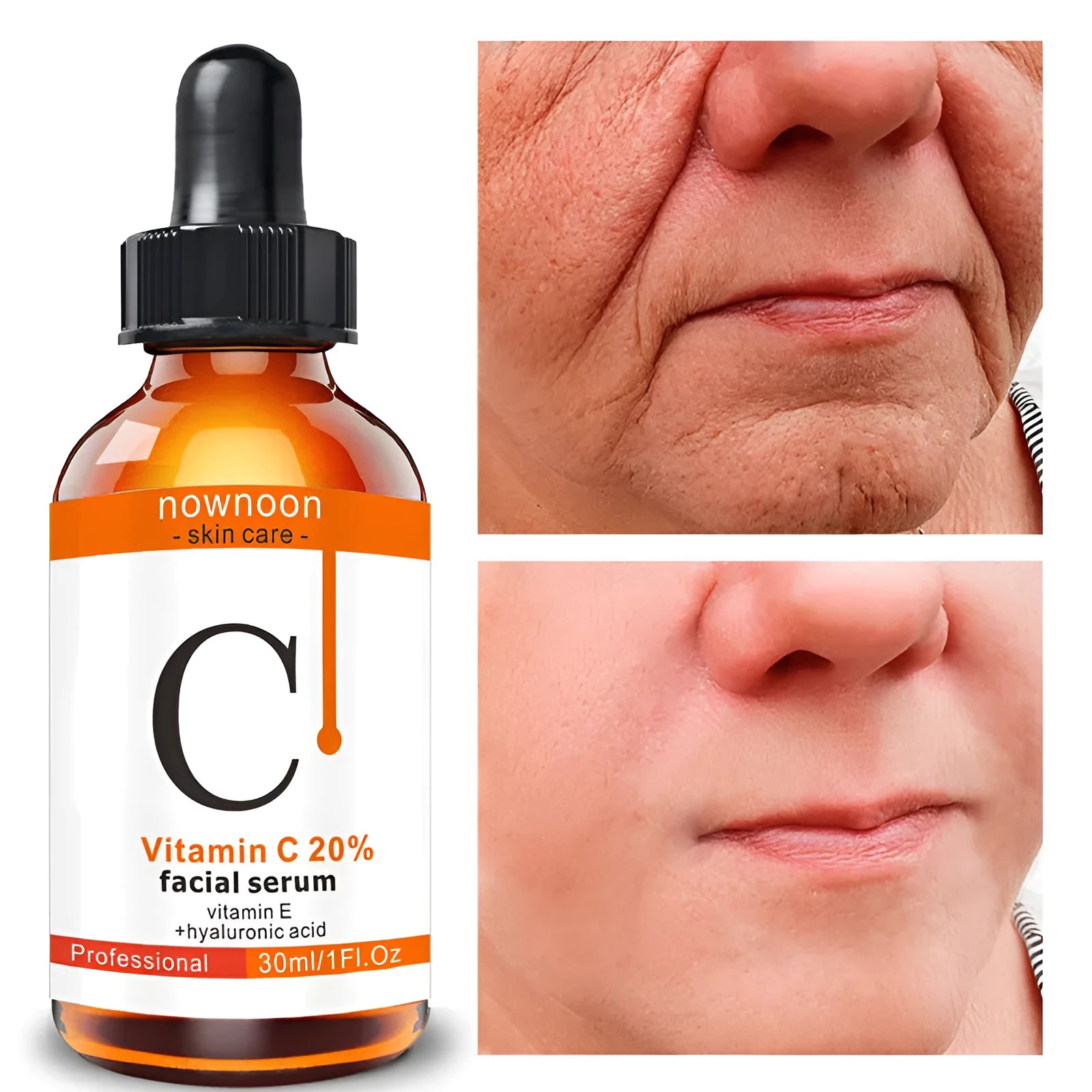 Vitamin C Facial Serum 30ml bottle with snow lotus extract for hydration, picture colour