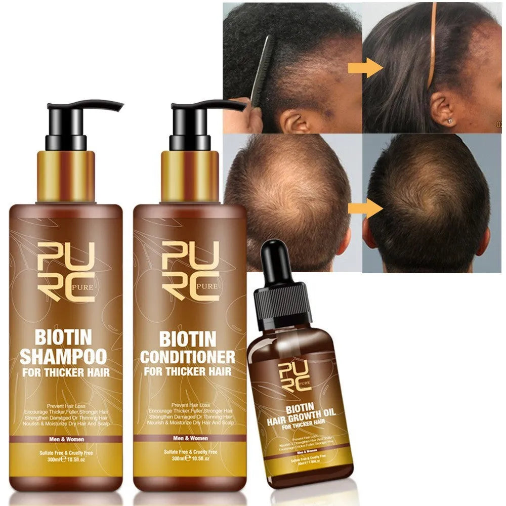 PURC Ginger Biotin Hair Care Set with 300ml shampoo, 300ml conditioner, and 30ml essential oil in white bottles