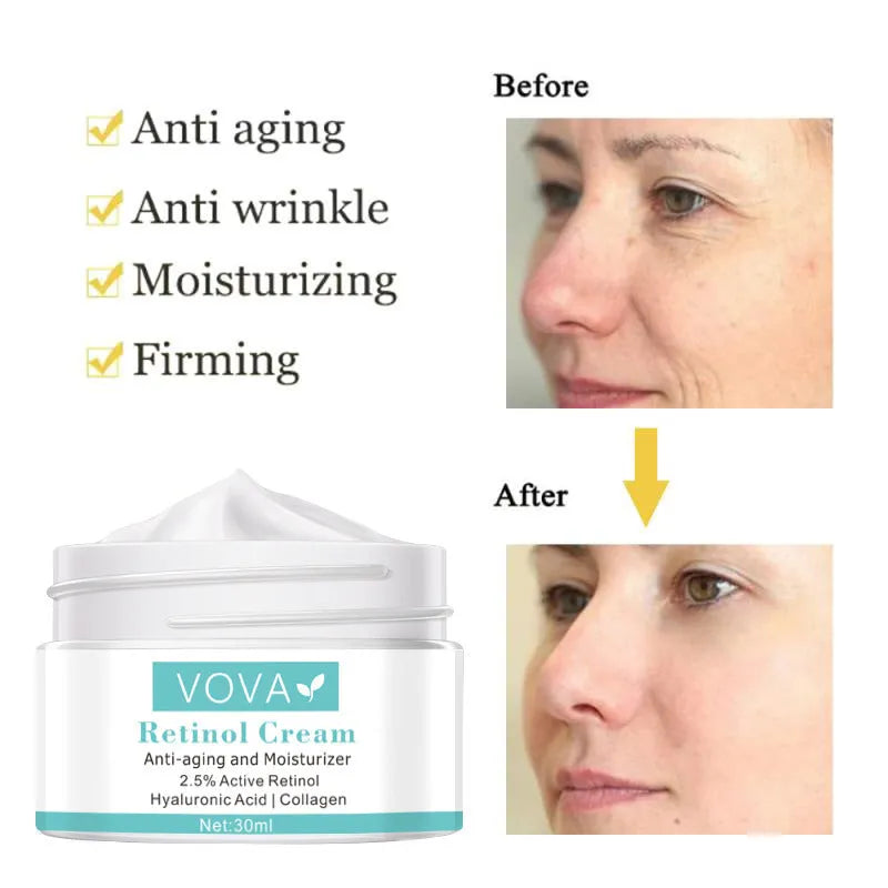 30ml anti-wrinkle cream jar with collagen and hyaluronic acid for tightening and moisturising