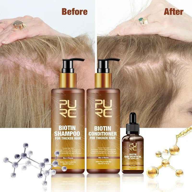 PURC Ginger Biotin Hair Care Set with 300ml shampoo, 300ml conditioner, and 30ml essential oil in white bottles
